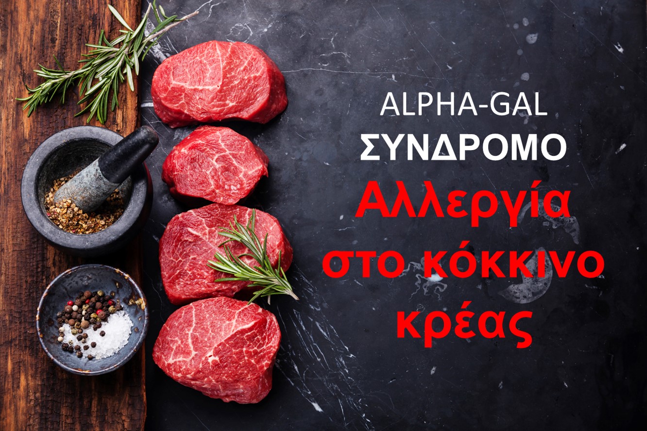 Αλλεργία στο κόκκινο κρέας